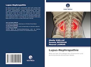 Lupus-Nephropathie