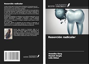 Resorción radicular