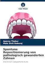 Spontane Repositionierung von pathologisch gewanderten Zähnen