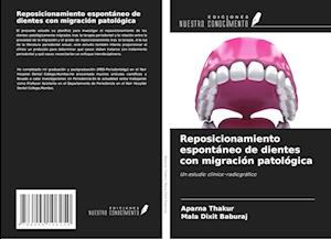 Reposicionamiento espontáneo de dientes con migración patológica