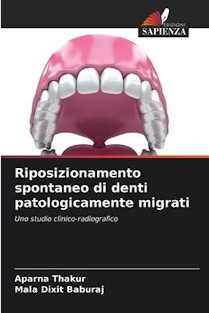 Riposizionamento spontaneo di denti patologicamente migrati