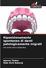 Riposizionamento spontaneo di denti patologicamente migrati