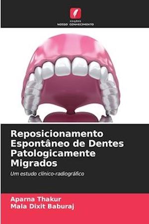 Reposicionamento Espontâneo de Dentes Patologicamente Migrados