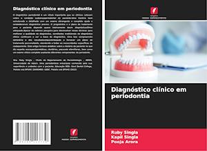 Diagnóstico clínico em periodontia