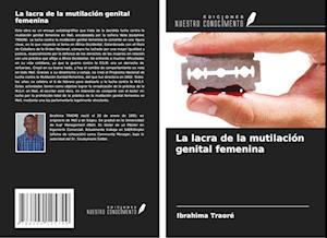 La lacra de la mutilación genital femenina