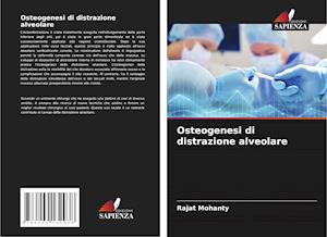 Osteogenesi di distrazione alveolare