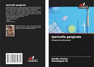 Ipertrofia gengivale