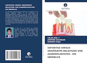 SOFORTIGE VERSUS VERZÖGERTE BELASTUNG VON ZAHNIMPLANTATEN - EIN ÜBERBLICK