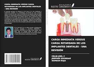 CARGA INMEDIATA VERSUS CARGA RETARDADA DE LOS IMPLANTES DENTALES - UNA REVISIÓN