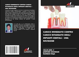 CARICO IMMEDIATO CONTRO CARICO RITARDATO DEGLI IMPIANTI DENTALI - UNA REVISIONE