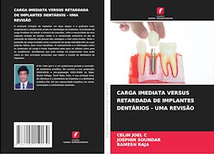 CARGA IMEDIATA VERSUS RETARDADA DE IMPLANTES DENTÁRIOS - UMA REVISÃO