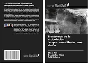 Trastornos de la articulación temporomandibular: una visión