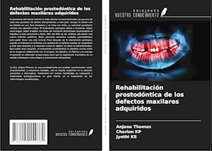 Rehabilitación prostodóntica de los defectos maxilares adquiridos