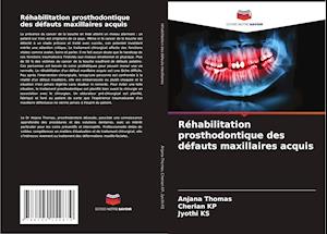 Réhabilitation prosthodontique des défauts maxillaires acquis