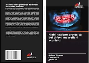 Riabilitazione protesica dei difetti mascellari acquisiti