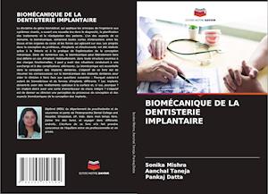 BIOMÉCANIQUE DE LA DENTISTERIE IMPLANTAIRE