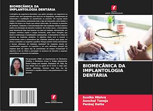 BIOMECÂNICA DA IMPLANTOLOGIA DENTÁRIA