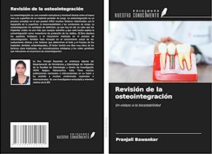 Revisión de la osteointegración