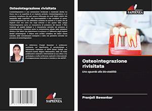 Osteointegrazione rivisitata