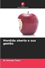 Mordida aberta e sua gestão