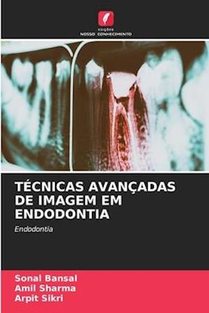 TÉCNICAS AVANÇADAS DE IMAGEM EM ENDODONTIA