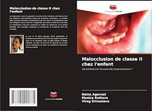 Malocclusion de classe II chez l'enfant