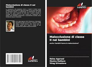 Malocclusione di classe II nei bambini