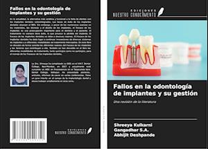 Fallos en la odontología de implantes y su gestión