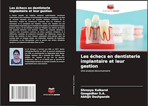 Les échecs en dentisterie implantaire et leur gestion