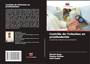 Contrôle de l'infection en prosthodontie