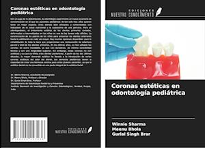 Coronas estéticas en odontología pediátrica