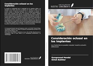 Consideración oclusal en los implantes