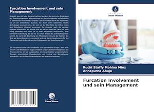 Furcation Involvement und sein Management