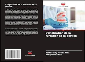 L'implication de la furcation et sa gestion