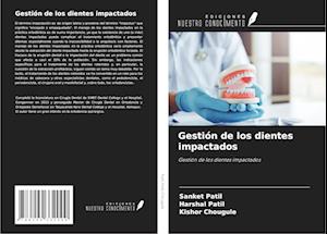 Gestión de los dientes impactados