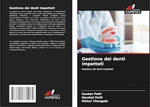 Gestione dei denti impattati