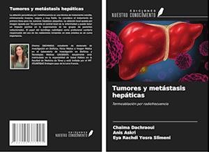 Tumores y metástasis hepáticas