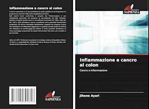 Infiammazione e cancro al colon