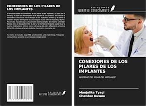 CONEXIONES DE LOS PILARES DE LOS IMPLANTES