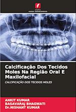 Calcificação Dos Tecidos Moles Na Região Oral E Maxilofacial