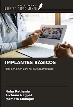 IMPLANTES BÁSICOS