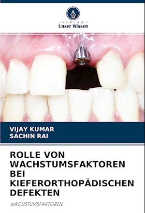 ROLLE VON WACHSTUMSFAKTOREN BEI KIEFERORTHOPÄDISCHEN DEFEKTEN