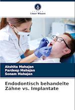 Endodontisch behandelte Zähne vs. Implantate