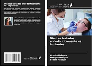 Dientes tratados endodónticamente vs. Implantes