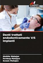 Denti trattati endodonticamente V/S impianti