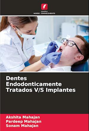 Dentes Endodonticamente Tratados V/S Implantes