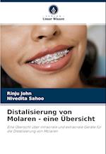 Distalisierung von Molaren - eine Übersicht