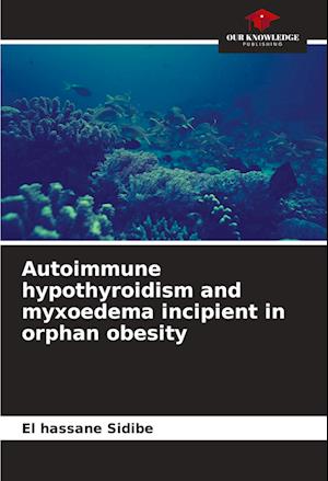 Autoimmune hypothyroidism and myxoedema incipient in orphan obesity