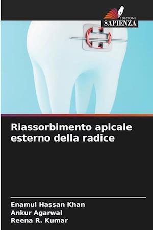 Riassorbimento apicale esterno della radice