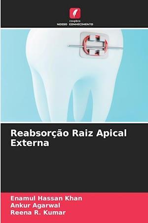 Reabsorção Raiz Apical Externa